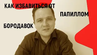 Как избавиться от папиллом и бородавок