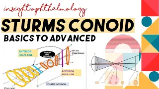 STURMS CONOID || APPLICATIONS AND CONCEPT || Types of astigmatism through sturm's conoid!