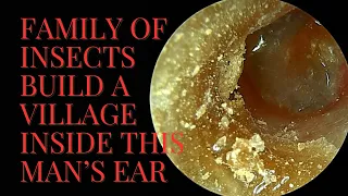 Family of Insects Make This Ear Their Village