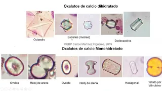 Taller Integrativo Curso Uroanálisis y Sedimento Urinario