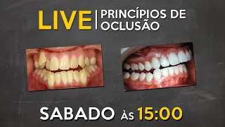 LIVE #042 - Princípios de Oclusão