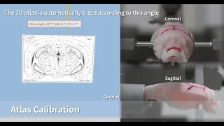 Automated Stereotaxic Instrument Operation-Accurate Position without Skull Adjust