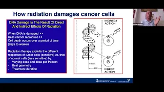 The Use of Radiation Therapy for Multiple Myeloma