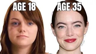 Emma Stone's Incredible Plastic Surgery Transformation