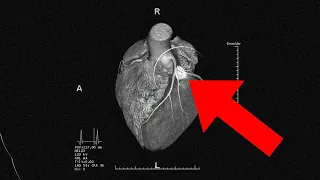 God's Revelation (to the) Human Heart