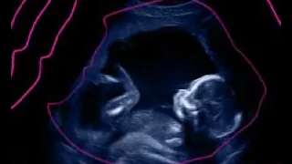 Voyage in utero : le 4e mois