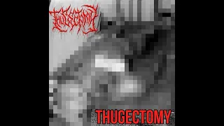 THUGECTOMY - Self-Titled (Full Album)