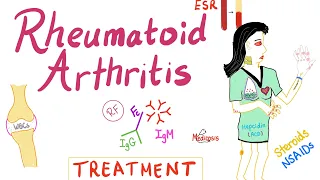 Rheumatoid Arthritis (RA) - Treatment and Management - Rheumatology Series