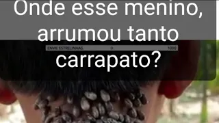 Onde esse Menino arrumou, tanto carrapato?