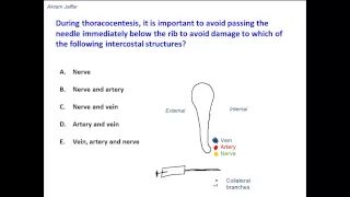 Relations of the intercostal neurovascular bundle