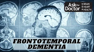 What is FTD or FrontoTemporal Dementia?