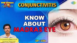 Madras Eye பற்றி தெரிந்து கொள்ளுங்கள் | conjunctivitis  | EP 246