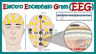 Electroencephalography (EEG) | How EEG test works? | What conditions can an EEG diagnose? | Animated