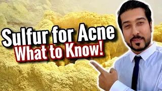 Sulfur for Acne Scars | How to Use Sulfur Soap, Masks, and Spot Treatment