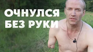 ОЧНУЛСЯ БЕЗ РУКИ ТЕПЕРЬ ТАНЦУЮ