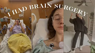 My Brain Surgery Story | Pituitary Tumor Removal