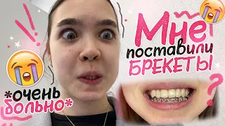 VLOG 😱 Мне ПОСТАВИЛИ БРЕКЕТЫ *очень больно*