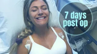 Plastic Surgery Experience / 7 day vlog