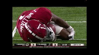 Jameson Williams gruesome knee injury!!!