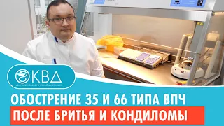 😦 Обострение 35 и 66 типа впч после бритья и мелкие кондиломы. Клинический случай №547