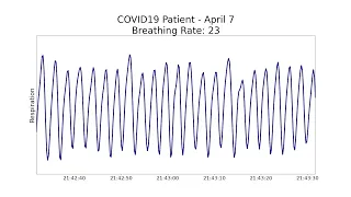 Non-contact health monitoring for COVID-19