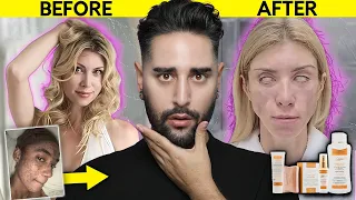 The Skincare Line That DESTROYED A Models Face & Career 💜 James Welsh