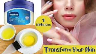 1 Night Challenge - VASELINE & EGG Mask - Transforms Your Face In one Night