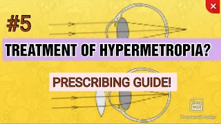 #5 TREATMENT OF HYPERMETROPIA || Principles of hypermetropic correction || AAO guidelines