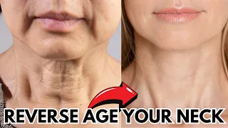 10 HOME Remedies for a YOUNGER LOOKING NECK (WOMEN OVER 50)