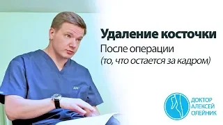 Удаление косточки: после операции (то, что остается за кадром) | Доктор Алексей Олейник