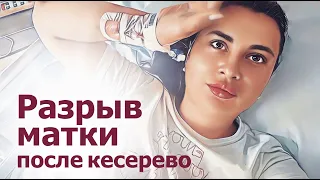 Разрыв матки после кесерево. Операция. Лапароскопия. Что нужно знать Мамам ?! Больница в Германии