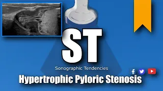 Pyloric Ultrasound