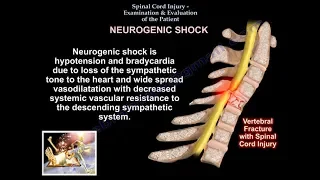 Spinal Cord injury , Examination & Evaluation  - Everything You Need To Know - Dr. Nabil Ebraheim