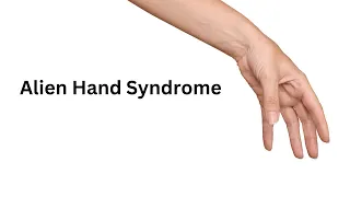 Alien Hand Syndrome