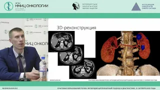 Компьютерная томография: «золотой стандарт» в диагностике образований почек? (Васильев А.В.)