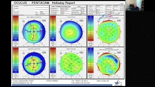 Cases in Corneal Tomography