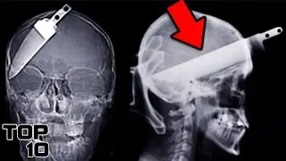 Top 10 Scary X-Ray Discoveries