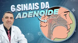 6 sinais da ADENOIDE HIPERTROFIADA  para você ficar atento(a) em seus filhos…