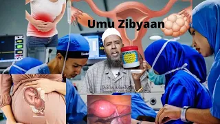 Qataraha UMU Zibyaan Iyo Dawo Cajiib ah Idanka Alle.Doc Sh.Yusuf Xoog