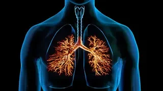 Bronchitis Home Remedies