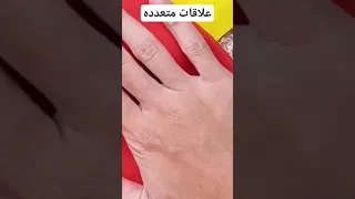 طلب زوجي الغريب لصاحبه #قصص_رون #قصص_ #كيكة #kick #رون #قصص_واقعية #viral #قصص #قصص_رعب_حدثت_بالفعل