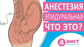 Как делается эпидуральная анестезия при родах?