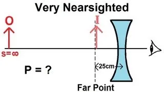 Physics - Optics: Vision Correction (3 of 5) Very Nearsighted