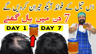 Hair Growth Oil Faster | Onion Juice For Dandruff/ Hair fall Control Premature | BaBa Food RRC