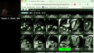 Stress MRI: Methodology, Current Role and Case Studies (Dipan Shah, MD) December 13, 2016
