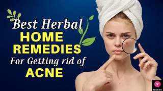 ★ Best Herbal Home Remedies For Getting Rid Of ACNE ★