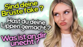 Noch NIE beantwortet : Sind deine Lippen gemacht ? 😳  Meine Meinung zu Schönheits-OP's | Dagi