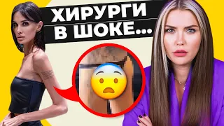 ЖУТКАЯ ПЛАСТИКА Аланы Мамаевой 😰 чем опасны импланты ягодиц?