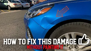 Hyundai Sonata Fender Smash | Paintless Dent Repair
