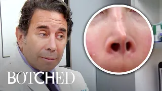 Most AMAZING Nose & Skin Surgeries From Dr. Paul Nassif | Botched | E!